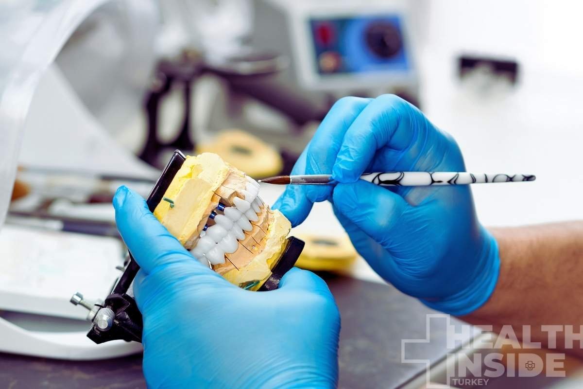 all-on-6-dental-implants-in-turkey-treatments-in-turkey-procedures